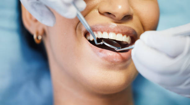 Best Emergency Denture Repair in Meeker, CO