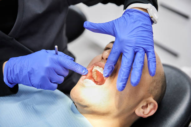 Best Emergency Denture Repair in Meeker, CO